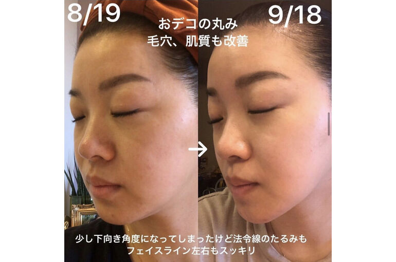 エキスパート効果