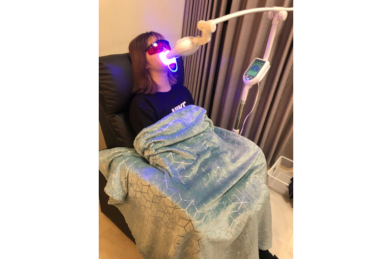 セルフホワイトニング